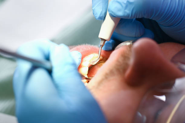 Best Emergency Broken Tooth Repair in Edgewood, MD